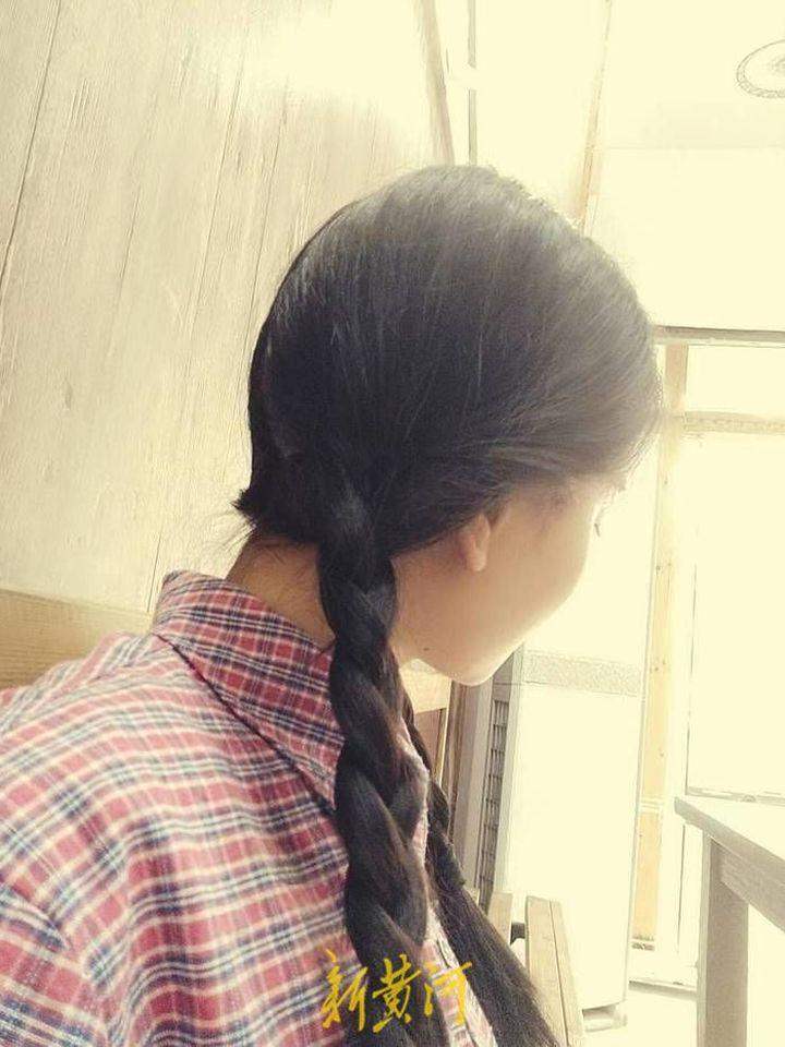 女孩被罕见病折磨28年：天一冷全身疼